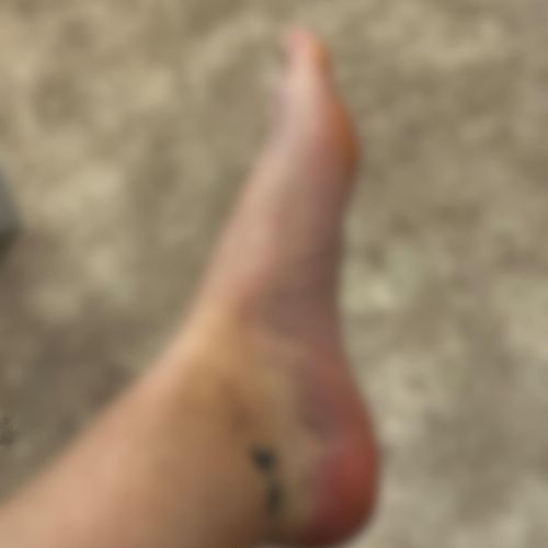 Two_feet_girls MYM