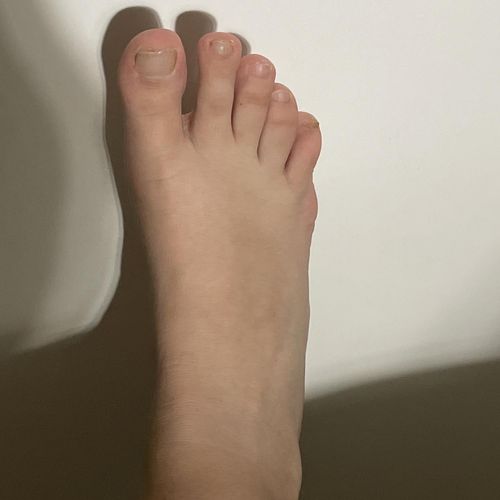 LovePhotoFoot MYM