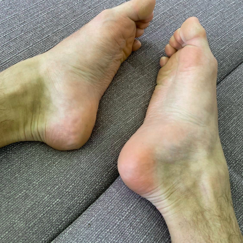 Boy_frenchfeet MYM