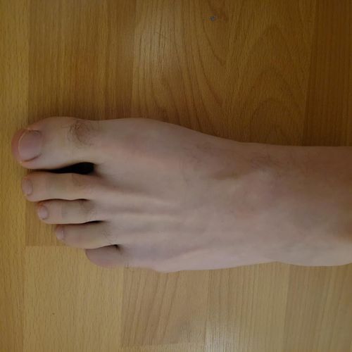 2_petit_pied MYM