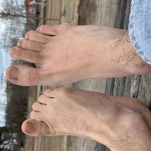 Feetflashporn MYM