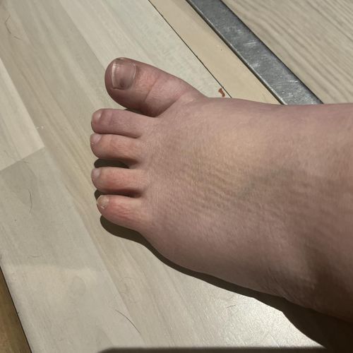 Footfetish- MYM