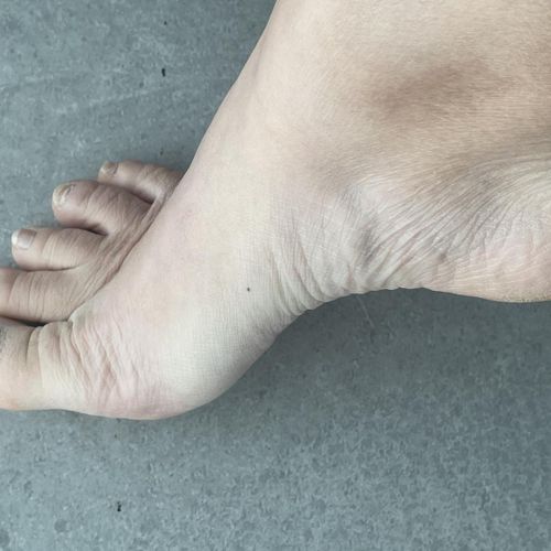 Uglyasianfeet MYM