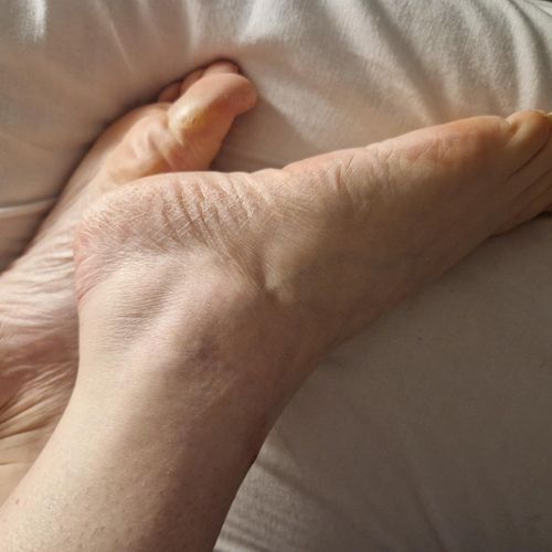Hand-foot MYM