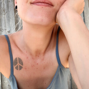 Amandacalyx MYM
