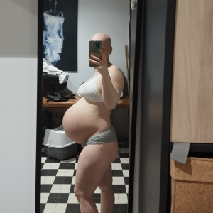 Analopecia60 MYM
