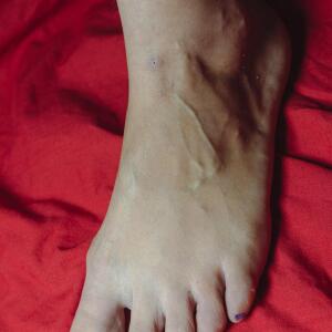 Clemencyfeet MYM