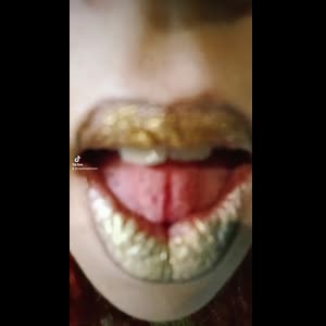 Couple_loquitos_sex MYM