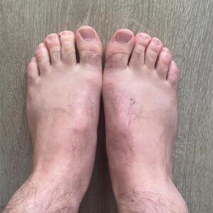 Crazeefeet MYM