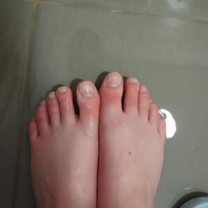 Edyppy MYM