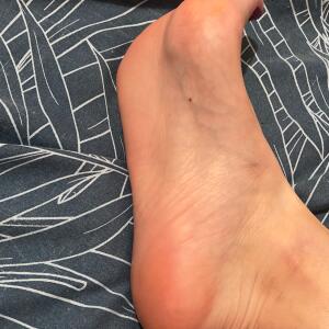 Erato_pieds MYM