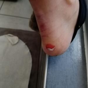Erogorefeet MYM