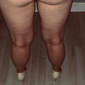 Feetlegsart MYM