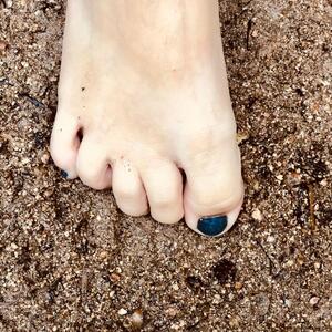 Feetlegsart MYM