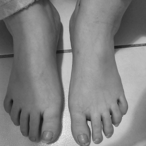 Feetonly8_8 MYM