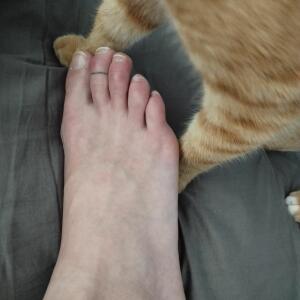 Footerotic MYM