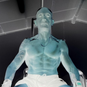 Francky-exhibnaturiste MYM