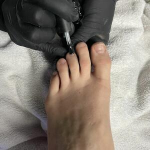 Frenchfeetduo MYM