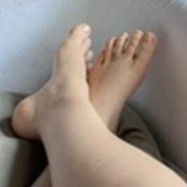 Hely_natural_feet MYM