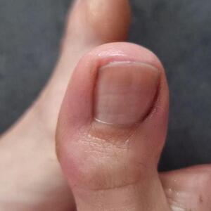 How_i_feet MYM