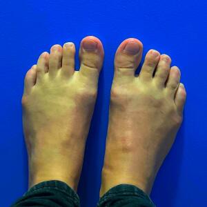 Kikifoot MYM
