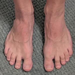 LT_Runnersfeet MYM