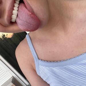 Linaluxa_ MYM