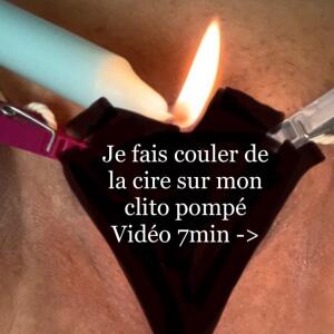 Lisadefis MYM