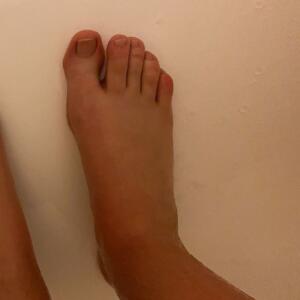 Livewithmy_feet MYM