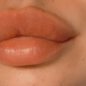 Ll_20 MYM