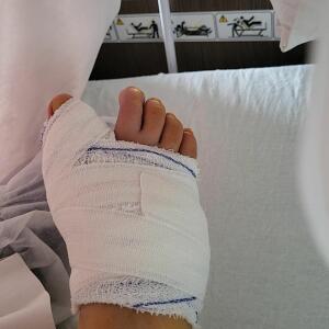 Lucia_halluxvalgus MYM