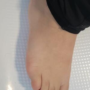 Magmafeet MYM