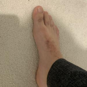 Marcel_pied MYM
