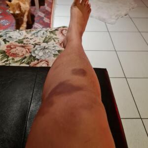 Mirah_medusa MYM