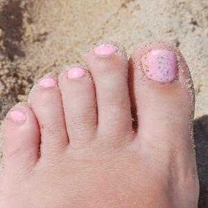 Papillon_foot MYM