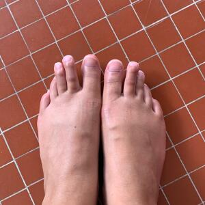 Pied_desiles MYM