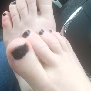 Pieds-76 MYM