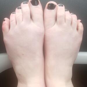 Pieds-76 MYM