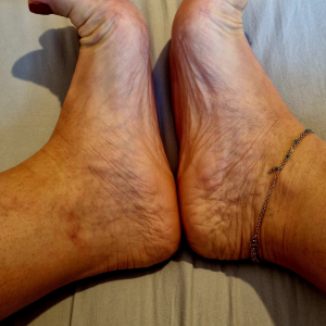 Pieds-doux38 MYM