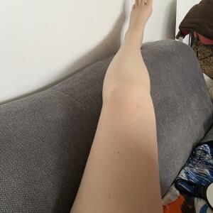 Pieds_dapolline MYM