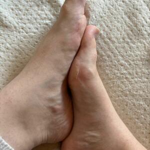 Stonkfeet_ MYM