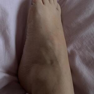 Takyfeet MYM