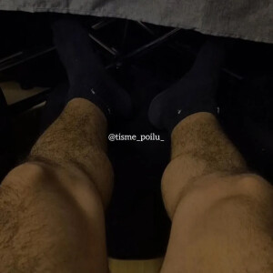 Tisme_poilu_ MYM