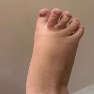 Uglyfeets45 MYM