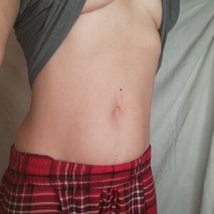 Zoeskin MYM